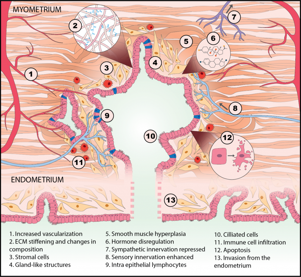 Research • The MIT Center for Gynepathology Research