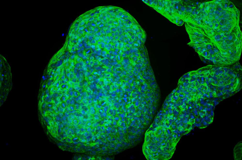 pancreatic-organoids