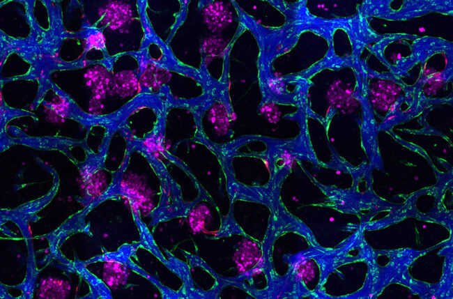 New Tissue Models Offer Insights into Disease Mechanisms and Drug Response