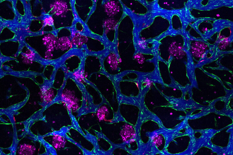 New Tissue Models Offer Insights into Disease Mechanisms and Drug Response